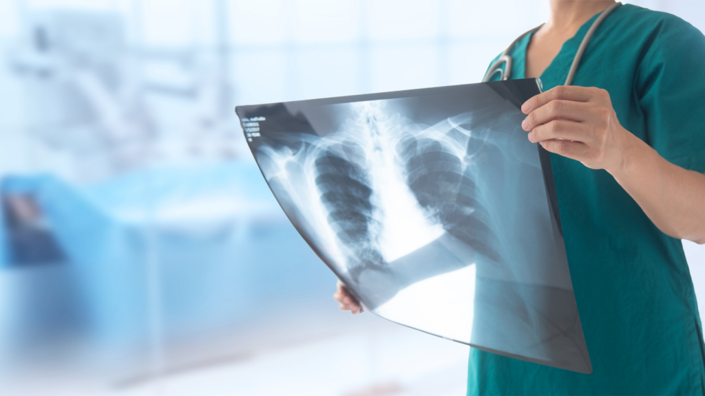 Travel X Ray tech working in high-paying hospital city in 2025